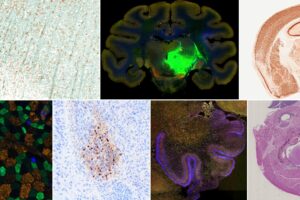 Immunohistochimie