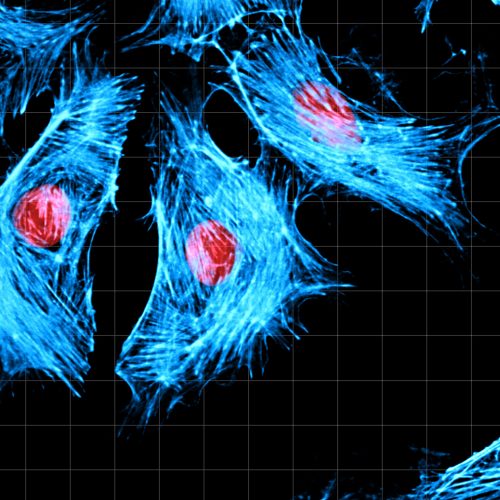 ImageJ=1.51n
unit=inch