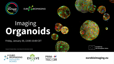 Special Edition Virtual Pub on 30/01/2026 (Eurobioimaging) – Imaging Organoids