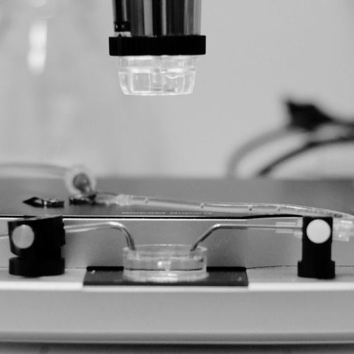 in vitro, ex vivo CMOS HD-MEA