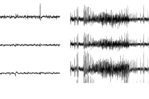 in vivo ELECTROPHYSIOLOGY
