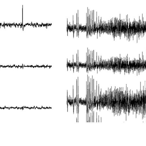 in vivo ELECTROPHYSIOLOGY